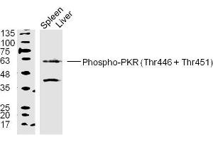 Image no. 2 for anti-Eukaryotic Translation Initiation Factor 2-alpha Kinase 2 (EIF2AK2) (pThr446), (pThr451) antibody (ABIN744818)