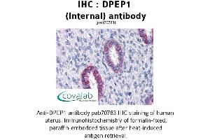 Image no. 2 for anti-Dipeptidase 1 (Renal) (DPEP1) (Internal Region) antibody (ABIN1733737)