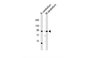 Image no. 2 for anti-Transient Receptor Potential Cation Channel, Subfamily V, Member 1 (TRPV1) (AA 124-153), (N-Term) antibody (ABIN657909)