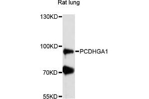 Image no. 1 for anti-Protocadherin gamma A1 (PCDHGA1) antibody (ABIN6291192)