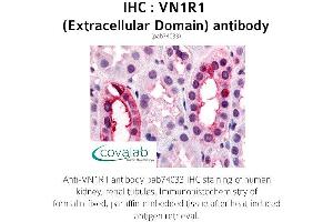 Image no. 1 for anti-Vomeronasal 1 Receptor 1 (VN1R1) (2nd Extracellular Domain) antibody (ABIN1740733)