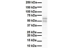 Image no. 9 for anti-Nuclear Receptor Subfamily 5, Group A, Member 1 (NR5A1) (Middle Region) antibody (ABIN2777447)