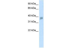 Image no. 1 for anti-Small Nuclear RNA Activating Complex, Polypeptide 3, 50kDa (SNAPC3) (N-Term) antibody (ABIN2778304)