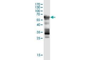 Image no. 3 for anti-Sex Comb On Midleg-Like 4 (SCML4) (AA 1-305) antibody (ABIN2752441)