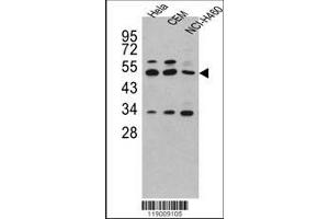 Image no. 1 for anti-Carboxypeptidase A4 (CPA4) (AA 305-336), (C-Term) antibody (ABIN391510)