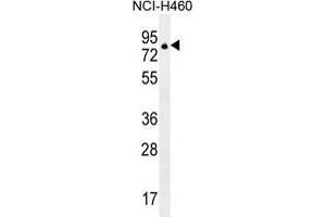 Image no. 1 for anti-Zinc Finger Protein 28 (ZFP28) (AA 94-123), (N-Term) antibody (ABIN955697)