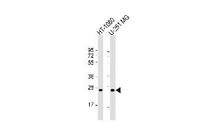 All lanes : Anti-ULBP2 Antibody (Center) at 1:1000 dilution Lane 1: HT-1080 whole cell lysate Lane 2: U-251 MG whole cell lysate Lysates/proteins at 20 μg per lane.