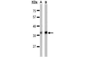 WB Image Sample(30 μg of whole cell lysate) A:MOLT4 , B:Raji , 15% SDS PAGE antibody diluted at 1:1000