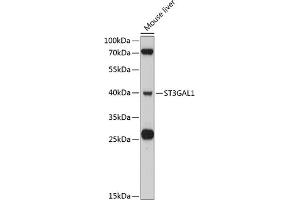 ST3GAL1 antibody  (AA 35-135)