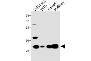 MARCH5 antibody  (N-Term)