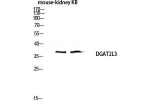Image no. 2 for anti-Acyl-CoA Wax Alcohol Acyltransferase 1 (AWAT1) (C-Term) antibody (ABIN3184289)