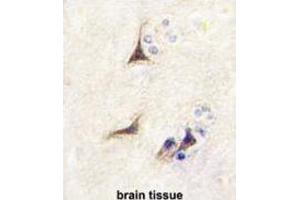 Image no. 3 for anti-Nerve Growth Factor beta (NGFB) antibody (ABIN3003483)