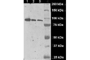 Image no. 3 for anti-Folate Hydrolase (Prostate-Specific Membrane Antigen) 1 (FOLH1) (AA 44-750) antibody (ABIN1302364)