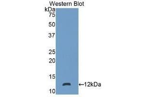 Detection of recombinant S100P using Polyclonal Antibody to S100 Calcium Binding Protein P (S100P)