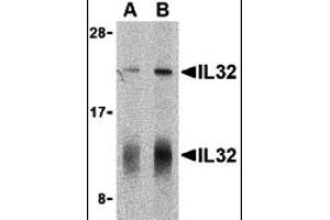 Western Blotting (WB) image for anti-Interleukin 32 (IL32) (C-Term) antibody (ABIN1030437)