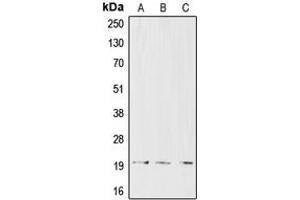 Image no. 2 for anti-CD3d Molecule, delta (CD3-TCR Complex) (CD3D) (Center) antibody (ABIN2705792)