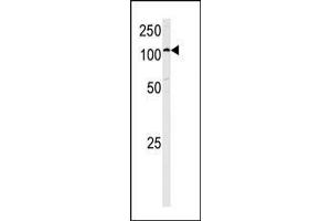Image no. 1 for anti-Hexokinase 1 (HK1) (AA 705-734), (C-Term) antibody (ABIN392760)