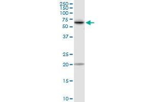 Image no. 4 for anti-Transketolase (TKT) (AA 1-623) antibody (ABIN948567)
