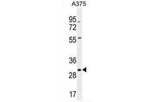 Image no. 3 for anti-Coatomer Protein Complex, Subunit epsilon (COPE) (AA 280-308), (C-Term) antibody (ABIN951610)