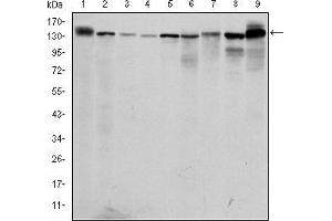 Image no. 5 for anti-Protein Kinase N2 (PKN2) antibody (ABIN969363)