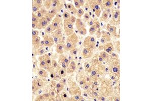 (ABIN6243863 and ABIN6578454) staining PYGL in human liver tissue sections by Immunohistochemistry (IHC-P - paraformaldehyde-fixed, paraffin-embedded sections).