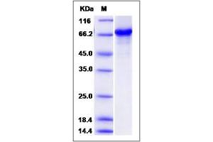 Image no. 1 for serum Response Factor Binding Protein 1 (SRFBP1) (AA 1-429) protein (GST tag,His tag) (ABIN2006190)