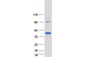 Image no. 1 for STIP1 Homology and U-Box Containing Protein 1 (STUB1) protein (Myc-DYKDDDDK Tag) (ABIN2732910)