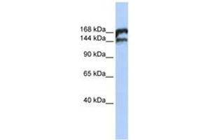 Image no. 1 for anti-Topoisomerase (DNA) II beta 180kDa (TOP2B) (AA 1548-1597) antibody (ABIN6742741)