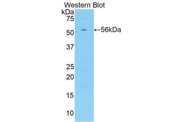 anti-Killer Cell Immunoglobulin-Like Receptor, three Domains, Long Cytoplasmic Tail, 2 (KIR3DL2) (AA 184-435) antibody