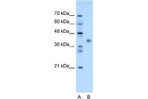 Image no. 1 for anti-Transmembrane Protein 59-Like (TMEM59L) (N-Term) antibody (ABIN2782769)