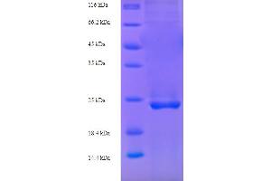 CAMK2N1 Protein (Calcium/calmodulin-Dependent Protein Kinase II Inhibitor 1) (AA 1-78, full length) (His-SUMO Tag)