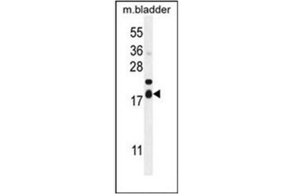 F162A antibody  (C-Term)