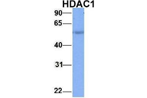 Image no. 4 for anti-Histone Deacetylase 1 (HDAC1) (Middle Region) antibody (ABIN2779587)