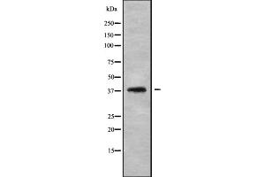 Image no. 2 for anti-Leukotriene B4 Receptor (LTB4R) antibody (ABIN6263018)