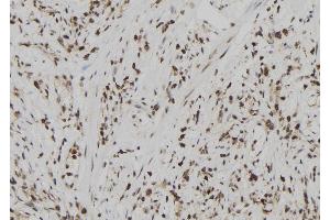 Image no. 1 for anti-Ubiquitin Specific Peptidase 39 (USP39) (N-Term) antibody (ABIN6265927)