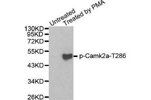 Image no. 1 for anti-Calcium/calmodulin-Dependent Protein Kinase II alpha (CAMK2A) (pThr286) antibody (ABIN3019947)