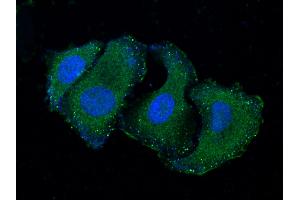 Image no. 1 for anti-RELT Tumor Necrosis Factor Receptor (RELT) (AA 1-160) antibody (ABIN1997059)