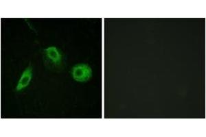 Immunofluorescence analysis of HeLa cells, using PLCG2 (Phospho-Tyr1217) Antibody.