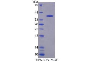 Image no. 1 for Regulator of G-Protein Signaling 9 (RGS) (AA 1-296) protein (His tag) (ABIN6239415)