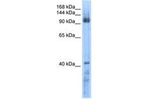Image no. 1 for anti-RecQ Protein-Like 5 (RECQL5) (AA 431-480) antibody (ABIN6736603)