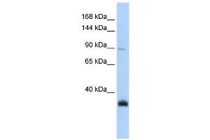 Image no. 1 for anti-MORC Family CW-Type Zinc Finger 3 (MORC3) (N-Term) antibody (ABIN630711)