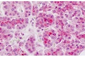 Image no. 1 for anti-Alveolar Soft Part Sarcoma Chromosome Region, Candidate 1 (ASPSCR1) (AA 392-418) antibody (ABIN1804342)