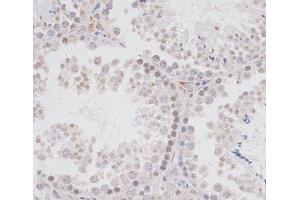 Immunohistochemistry of paraffin-embedded Mouse testis using KDM3A Polyclonal Antibody at dilution of 1:100 (40x lens).