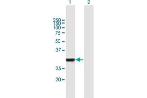 Image no. 1 for anti-Interleukin-1 Receptor-Associated Kinase 1 Binding Protein 1 (IRAK1BP1) (AA 1-260) antibody (ABIN530724)