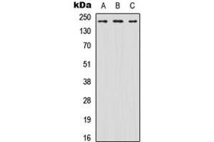 Image no. 1 for anti-Sodium Channel, Voltage-Gated, Type VIII, alpha (SCN8A) (N-Term) antibody (ABIN2707646)