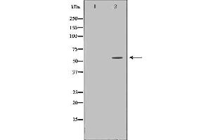 Image no. 1 for anti-Galactosamine (N-Acetyl)-6-Sulfate Sulfatase (GALNS) (Internal Region) antibody (ABIN6261875)