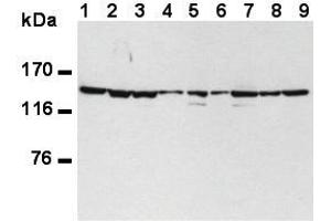 Image no. 3 for anti-Splicing Factor 3b, Subunit 1, 155kDa (SF3B1) (AA 98-198) antibody (ABIN1449241)