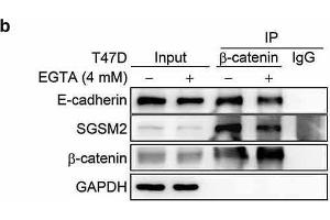 Interaction between SGSM2 and E-cadherin was verified by co-immunoprecipitation and immunofluorescence staining assays.