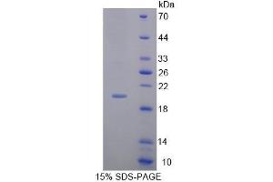 Image no. 6 for Matrix Metallopeptidase 13 (Collagenase 3) (MMP13) ELISA Kit (ABIN6720554)