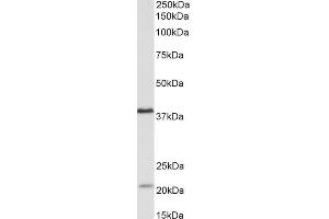 Image no. 1 for anti-Kelch Domain Containing 8B (KLHDC8B) (Internal Region) antibody (ABIN870682)